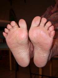 bejaarde voeten